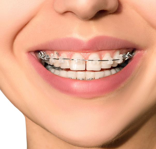 orthodontics pic