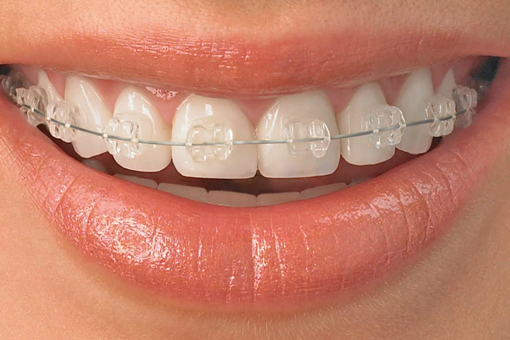 ortho1